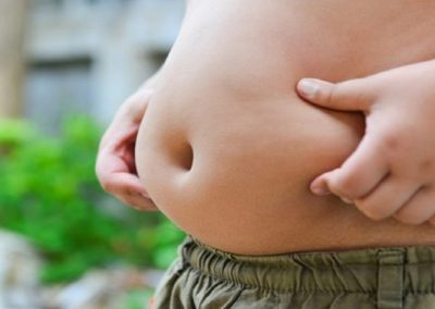 La obesidad mucho más que un factor de riesgo