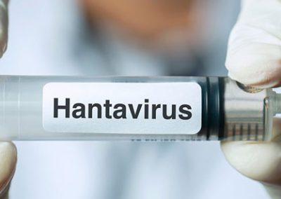 Hantavirus: Síntomas, contagio y medidas de prevención
