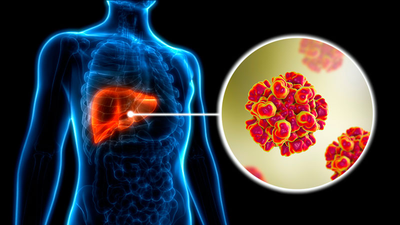 28 de julio: Día Mundial contra la Hepatitis
